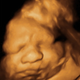 Illustration for article titled Gah! 3D Ultrasound Nightmare Fuel!
